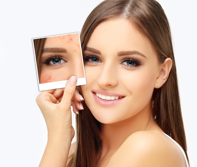 目元 シワ たるみ エイジングケア