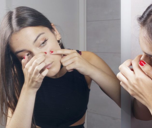 ニキビをファンデーションでカバー!隠せるファンデは?低刺激なのは?