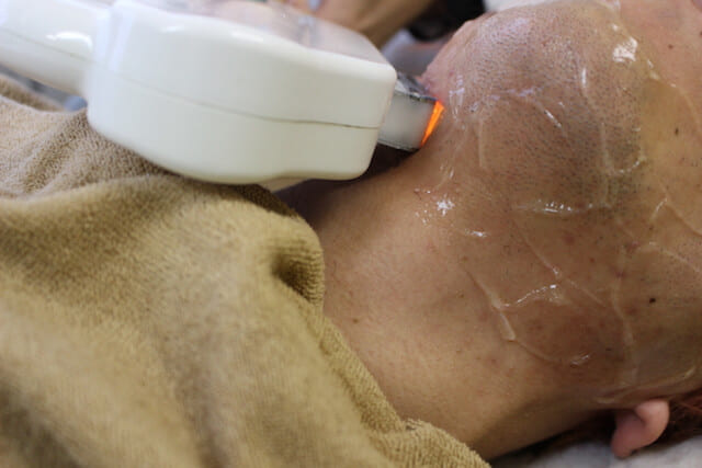 メンズクリア 顎