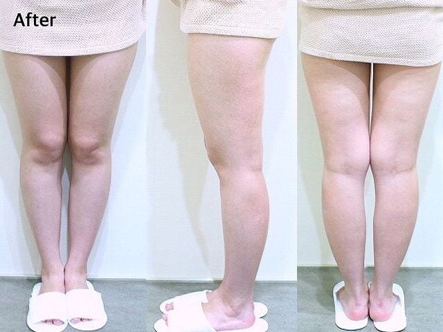 セルライトエステ シーズラボ