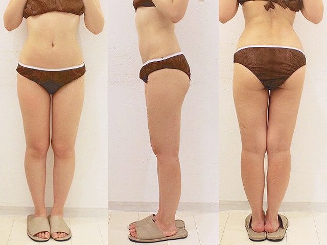 セルライトエステ フェイバリックス