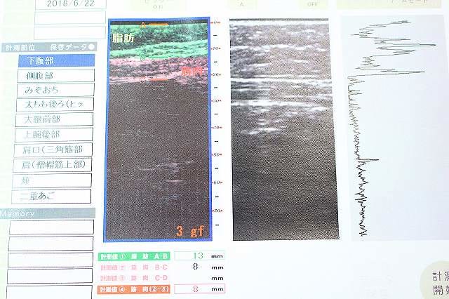 セルライトエステ シーズラボ